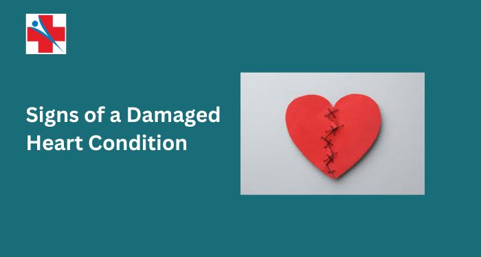 Signs of a Damaged Heart Condition | Early Symptoms & Treatment
